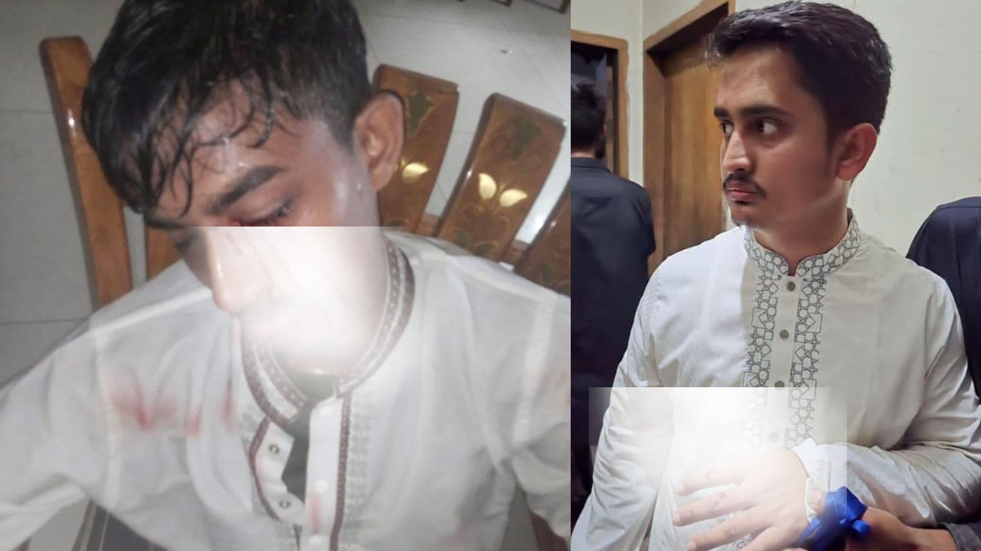 হামলায় আহত আলিফের এক চোখের দৃষ্টি নষ্ট হয়েছে, দাবি সারজিসের
